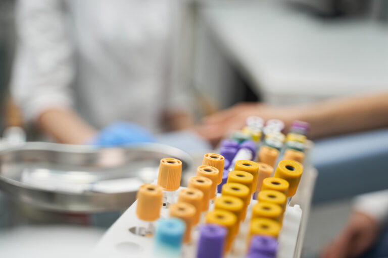 How to Design Plastic Parts for Easy Assembly