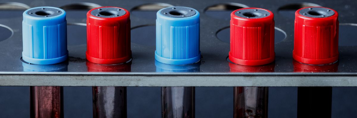 3 Things To Consider For Plastic Overmolding