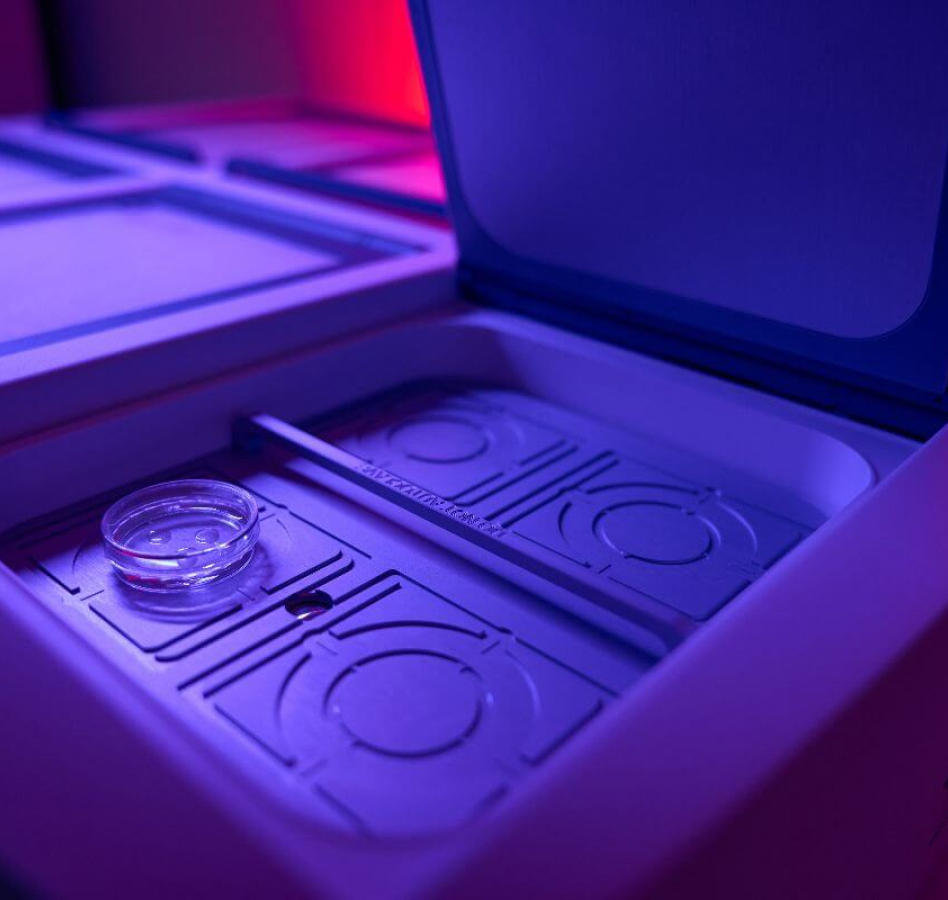 Customized Large Injection Molding Services for Complex Plastic Parts